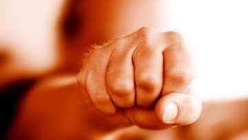 TKI Perempuan di Malaysia Dianiaya Majikan, Mata Kiri Lebam
