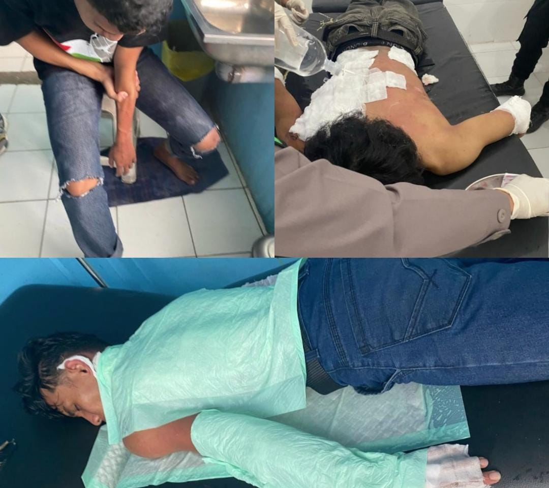 Mahasiswa Disiram Bensin Hingga Terbakar Saat Demo, KAHMI Bulungan Kecam Dugaan Aksi Represif Polisi
