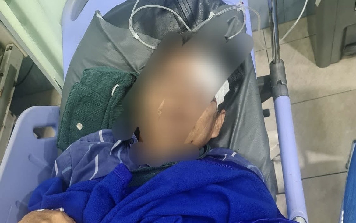 Diserang di Jalan Gelap, Guru di Kutim Jadi Korban Penganiayaan Brutal